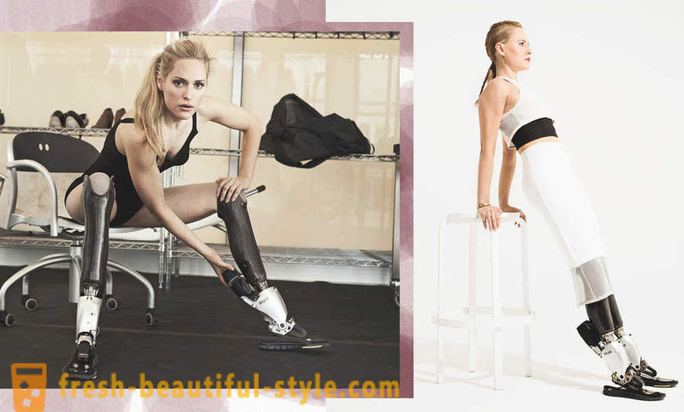 Infinite skjønnhet: 6 kvinnelige modeller med proteser