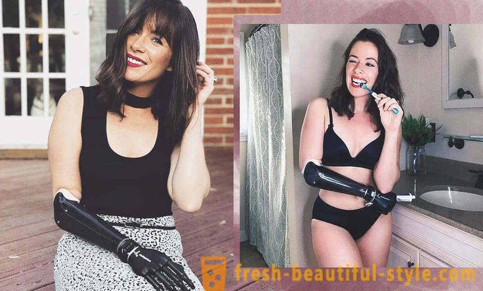 Infinite skjønnhet: 6 kvinnelige modeller med proteser