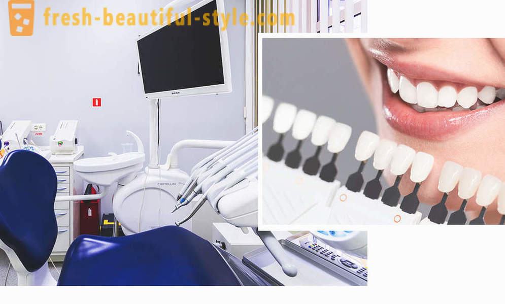 4, den ideelle måten å gjøre tennene