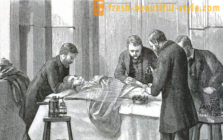 Sjokkerende fakta om den viktorianske kirurgi