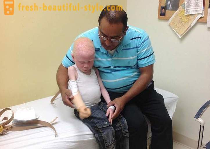 Den tragiske historien om tanzaniansk albinos
