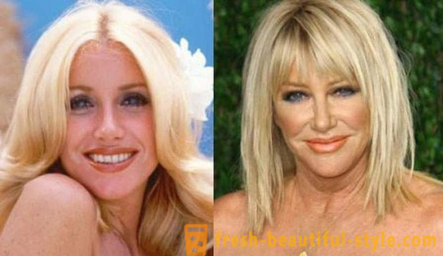 15 kjendiser, ferdig dårlig med Botox