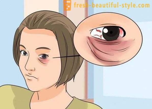 Hvordan å maskere et svart øye fra et slag: kosmetikk, spesielt anbefalinger og