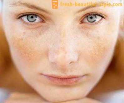 Hvorfor skjellende hud i ansiktet? Problem ansiktshuden