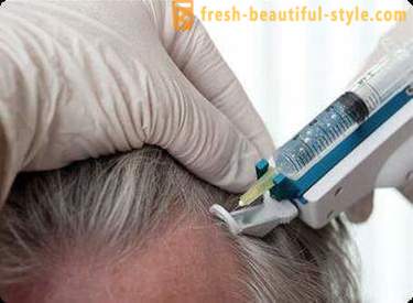 Mesotherapy for hår: Makeup verktøy og kontraindikasjoner