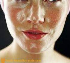 Fet hud ansikt: hva du skal gjøre for å håndtere problemet?